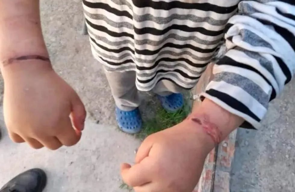 Esta imagen es la de un nene que fue encontrado en su casa atado con alambres junto a su hermana con síntomas de desnutrición.
