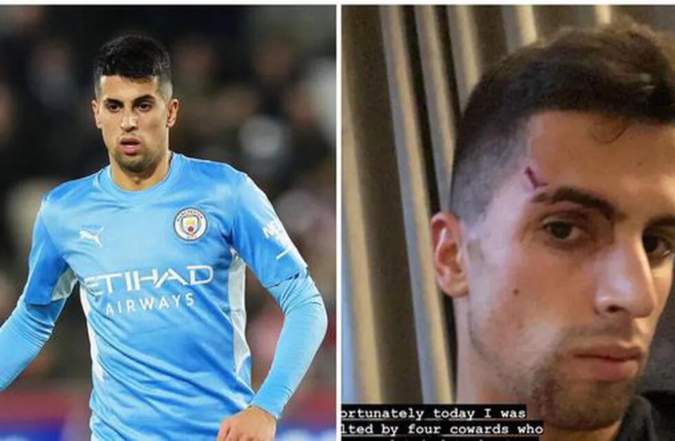 Así le quedó el rostro al futbolista portugués, tras el asalto.