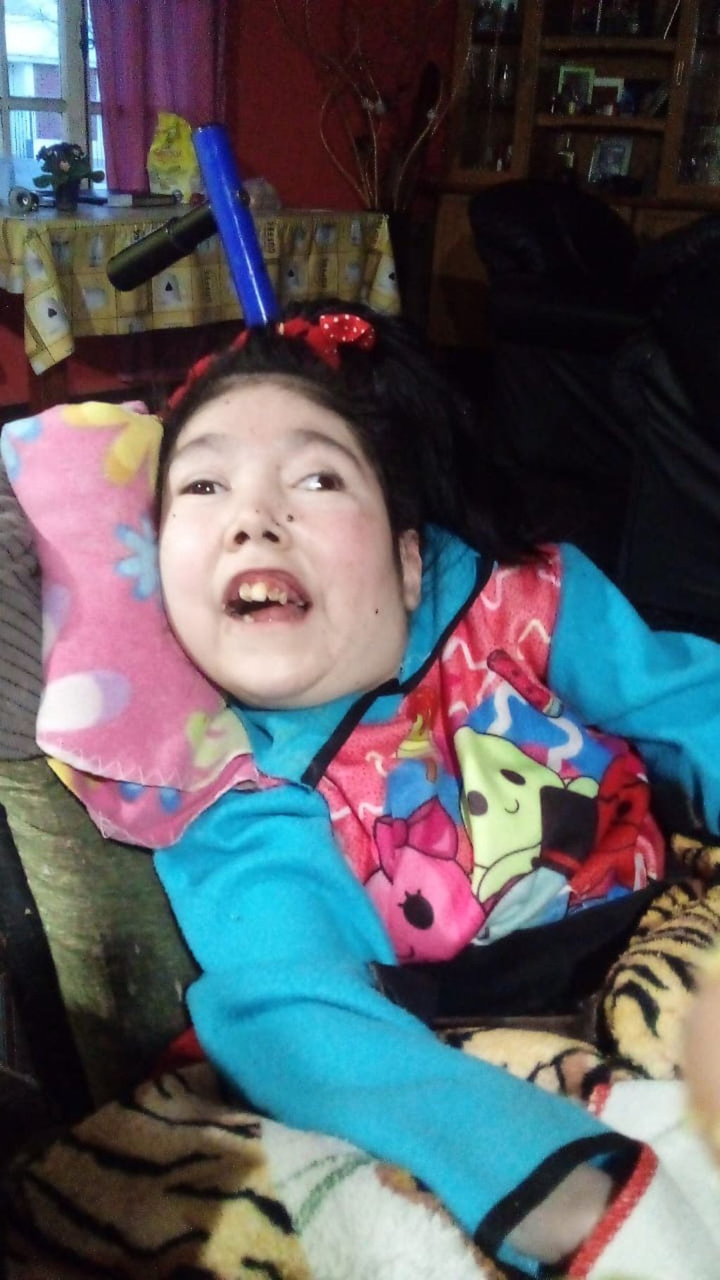 Romina está por cumplir 32 años y sufre de parálisis cerebral y escoliosis
