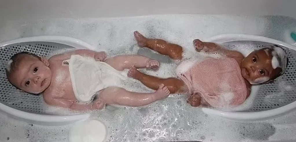 Una mamá se hizo viral por dar a luz a mellizos de distintos tonos de piel