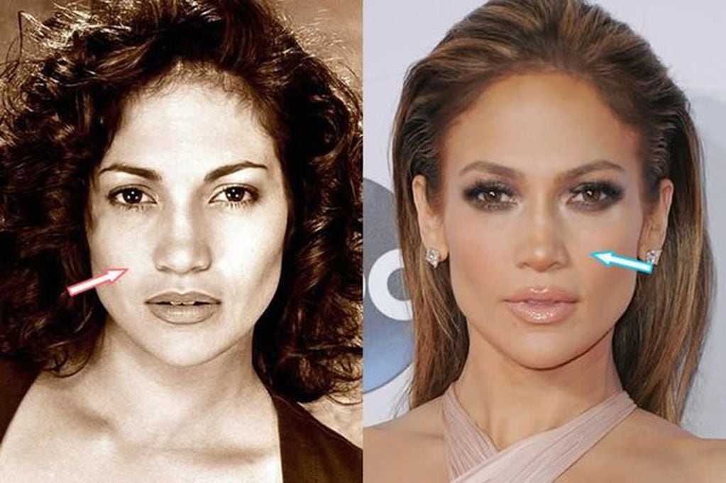 Estos son los cambios que se ha hecho Jennifer Lopez para verse más bella.