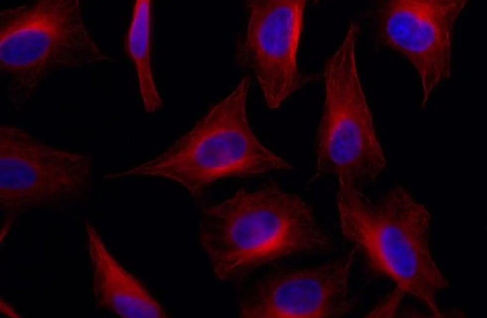 Imagen de microscopio especializado donde se usan nanoanticuerpos para detectar un tipo de proteínas llamado tubulina (rojo).