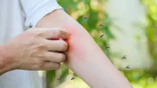 Invasión de mosquitos: cinco trucos eficaces que desconocías para ahuyentarlos