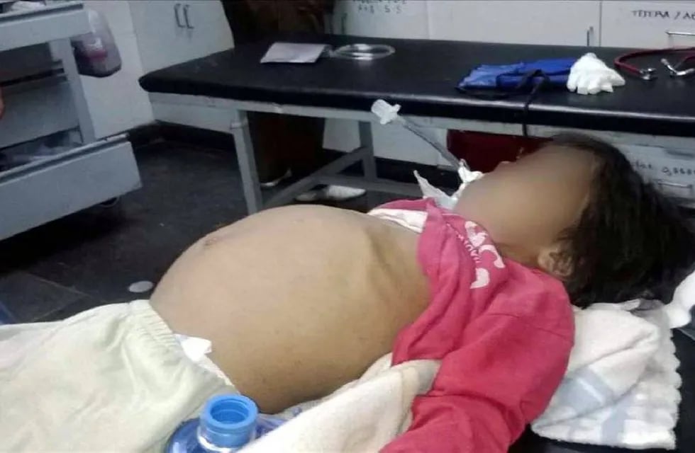 Alerta en Salta por dos muertes más de niños por desnutrición
