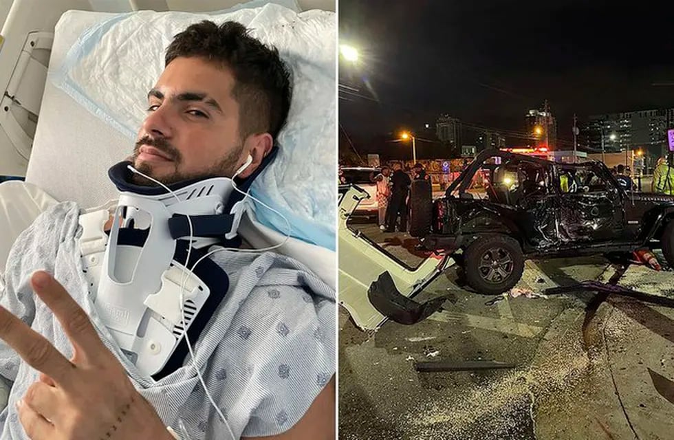 El cantante tuvo un accidente de tránsito en Miami, en donde está viviendo desde hace tres años. Foto: Gentileza