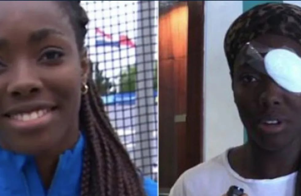 Ataque racista en Italia contra una atleta negra