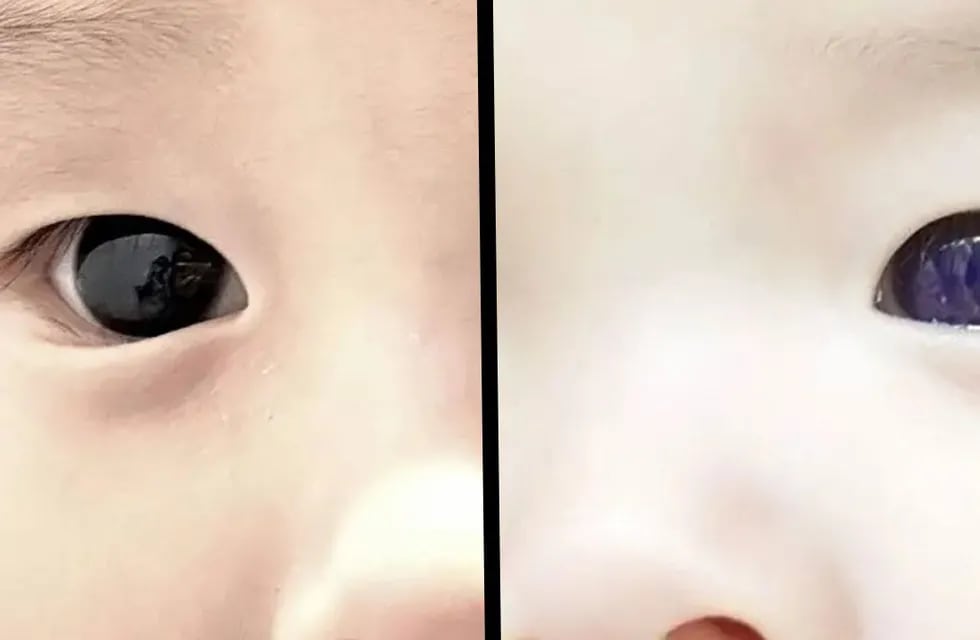 Le pusieron una medicación contra el Covid a un bebé de Tailandia y sus ojos cambiaron de color a las pocas horas (imagen ilustrativa).
