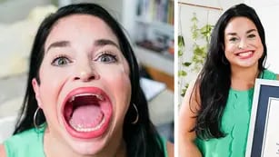 Video: Samantha, la mujer que batió el récord Guinness por tener la boca más grande del mundo