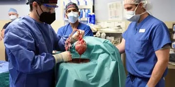 Inédito: trasplantan el corazón de un cerdo modificado genéticamente a una persona