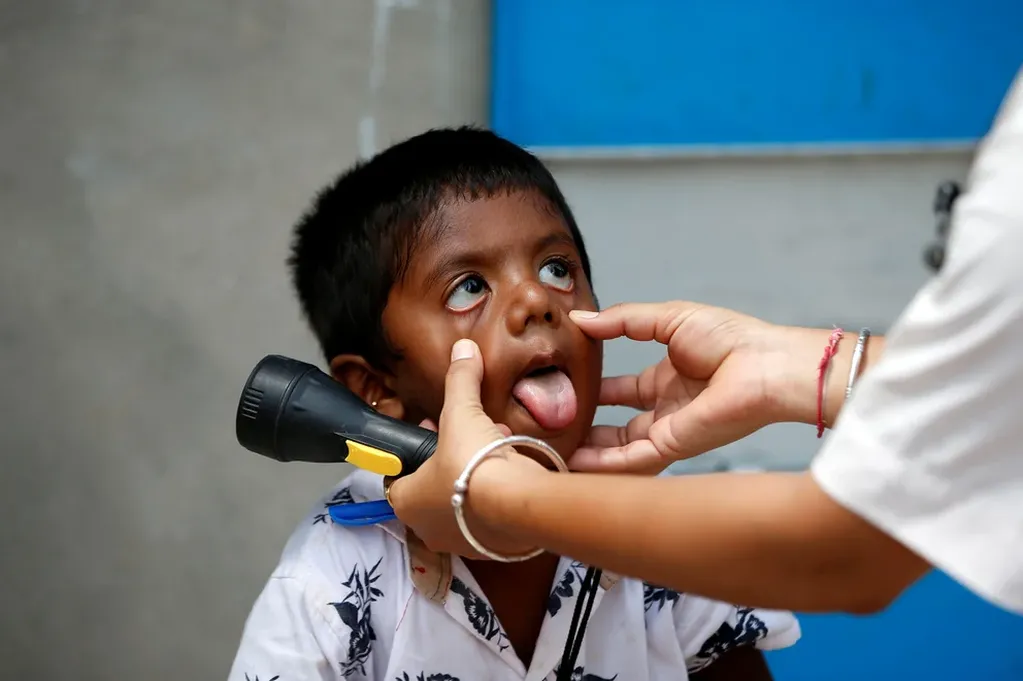 Imagen de referencia de un niño siendo revisado por un médico. Foto: Web
