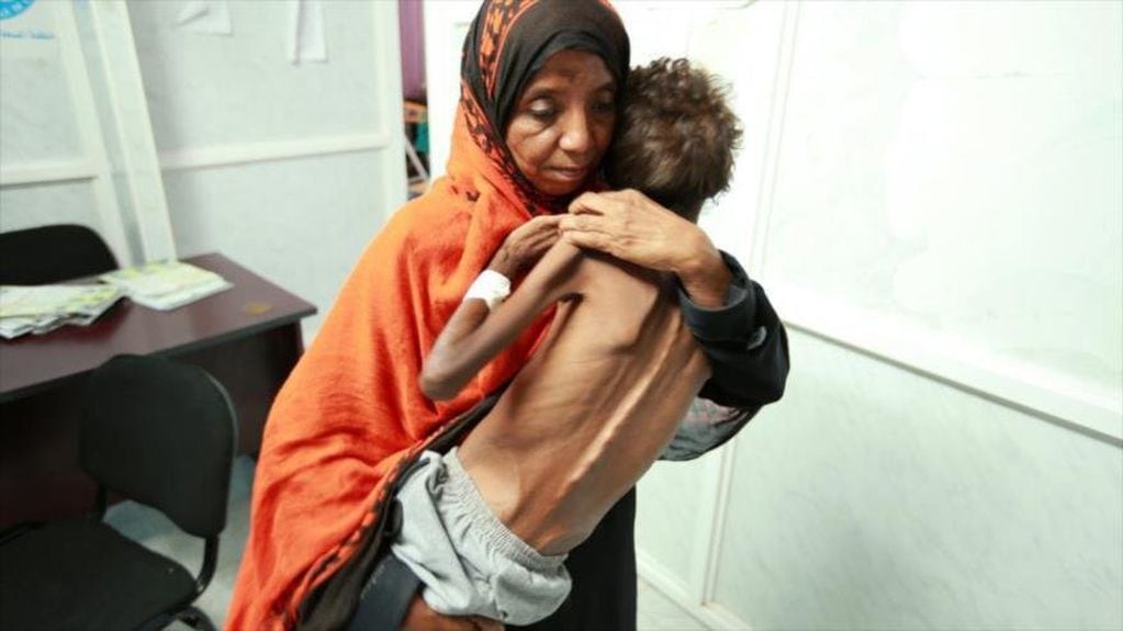 Según UNICEF,  ya en 2021 un niño yemení menor de 5 años moría de hambre cada 9 minutos. Con una nueva guerra, esta cifra empeorará dramáticamente.