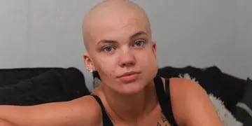 Kimberley Eccles (23) tiene cáncer y le avisaron por Zoom: pasó meses sin tratamiento por el Covid-19