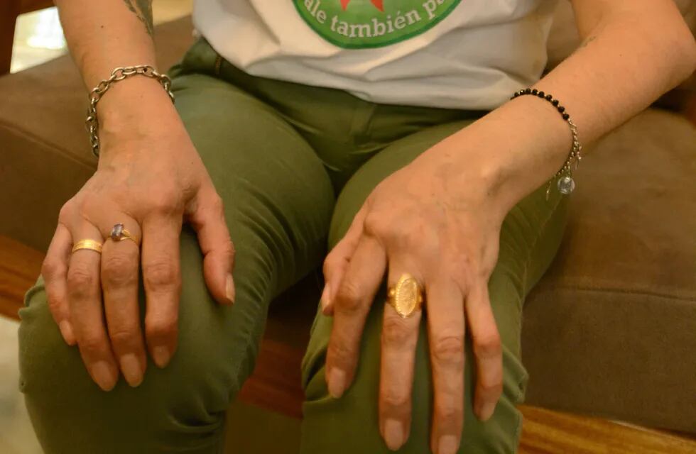 Unos 20 mil mendocinos tienen artritis reumatoidea
