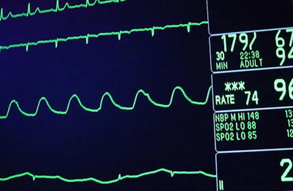 Red de telemedicina permite hacer electrocardiogramas a pacientes de zonas alejadas