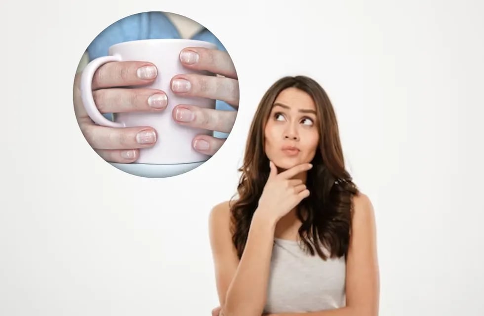 La verdad de por qué aparecen manchas blancas en las uñas.