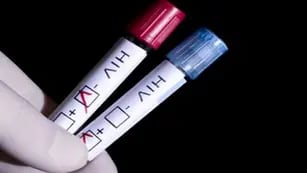 Test. Hay pruebas para la detección de VIH que facilita el diagnóstico precoz. 