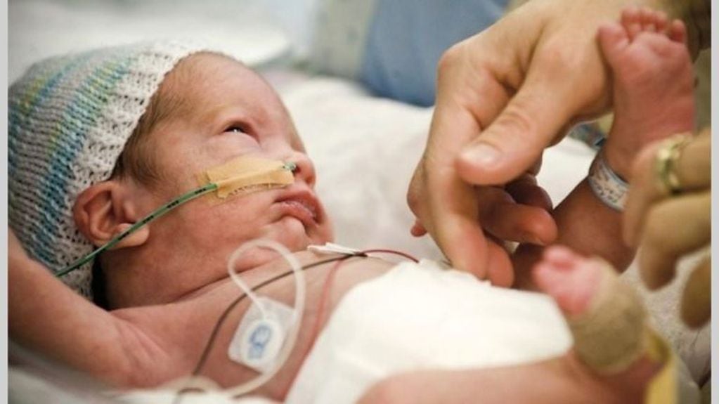 En Mendoza, hubo un aumento de la sobrevida de los bebés nacidos con menos de 1.500 gramos durante 2023 y ha alcanzado un promedio de 75% en general.

