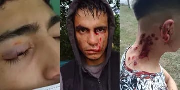 Violencia policial: entraron a una fiesta y le dispararon decenas de balas de goma a 11 adolescentes