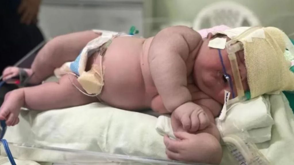 Nació un superbebé de más de 7 kilos en Brasil y estableció un nuevo récord.