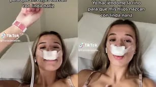 Video: el insólito motivo por el cual una tiktoker se operó la nariz