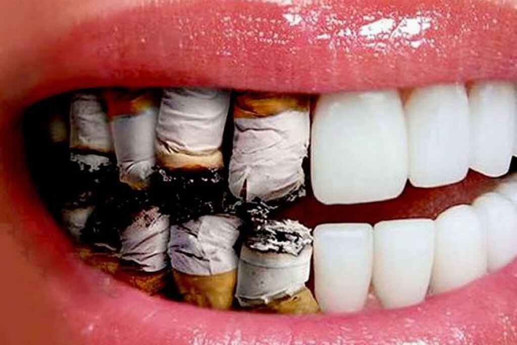 El tabaquismo aumenta el riesgo de caries y es uno de los factores de riesgo más prevalentes de la enfermedad periodontal. Foto: web.