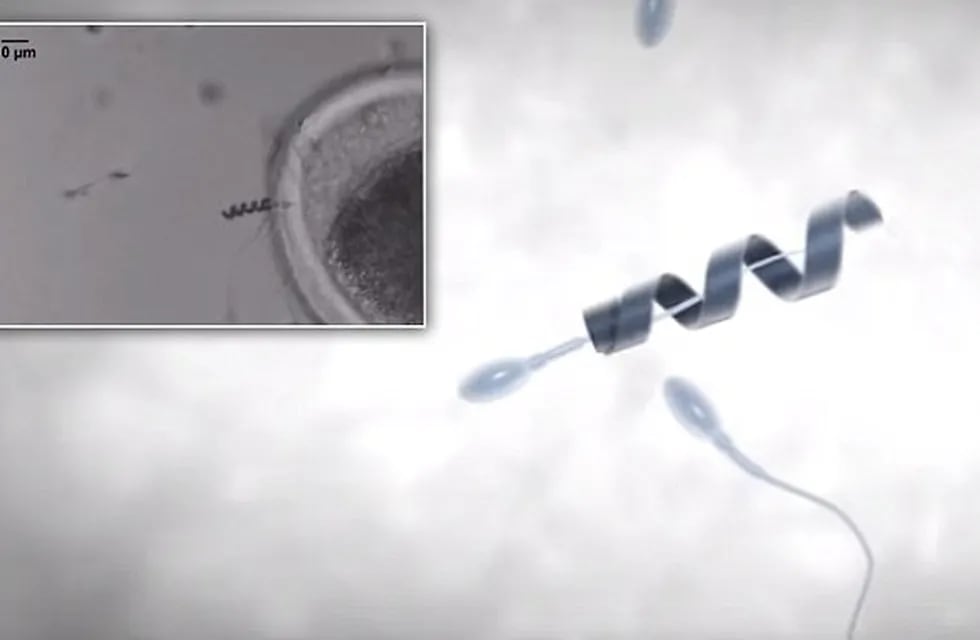 El ‘Spermbot’ podría ser una solución para la astenospermia. Foto: Web