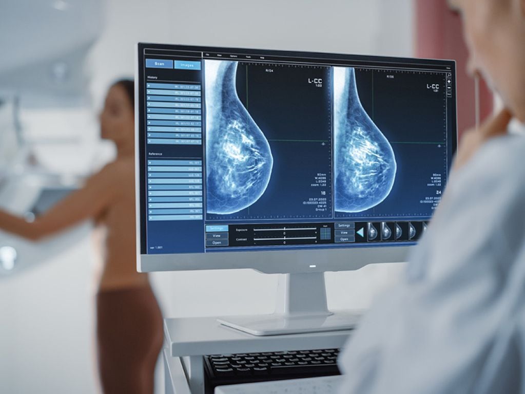 La mamografía anual se recomienda a partir de los 40 años.