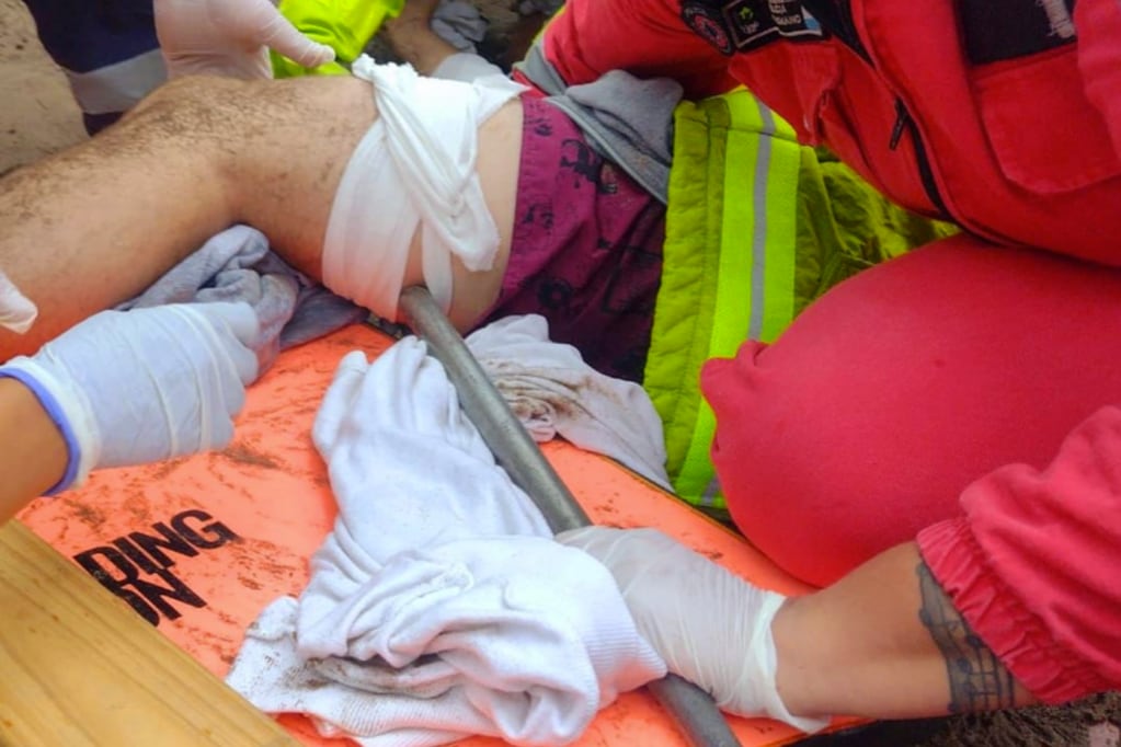 Una sombrilla se voló en Mar del Plata y terminó clavada en la pierna de un joven.