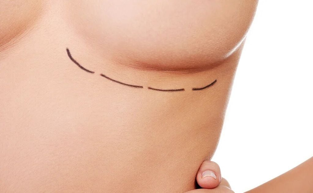 El procedimiento quirúrgico del aumento de pecho evita todo tipo de contacto con el músculo y la grasa.