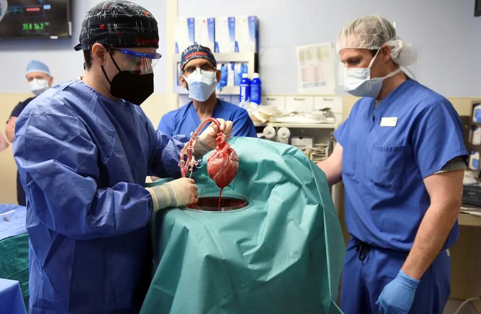 El cerdo del que provino el corazón trasplantado fue modificado genéticamente para evitar el rechazo inmediato - AP