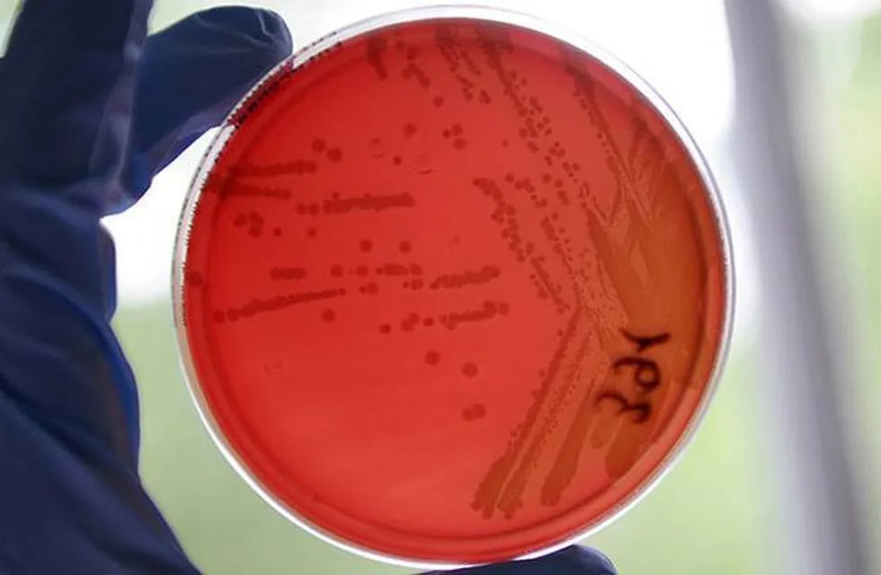 Una bacteria mortal escapó de un laboratorio de alta seguridad en EEUU