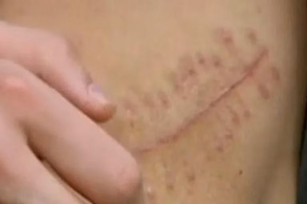 La cicatriz que le quedó a Xiao Wang. Foto: Web.