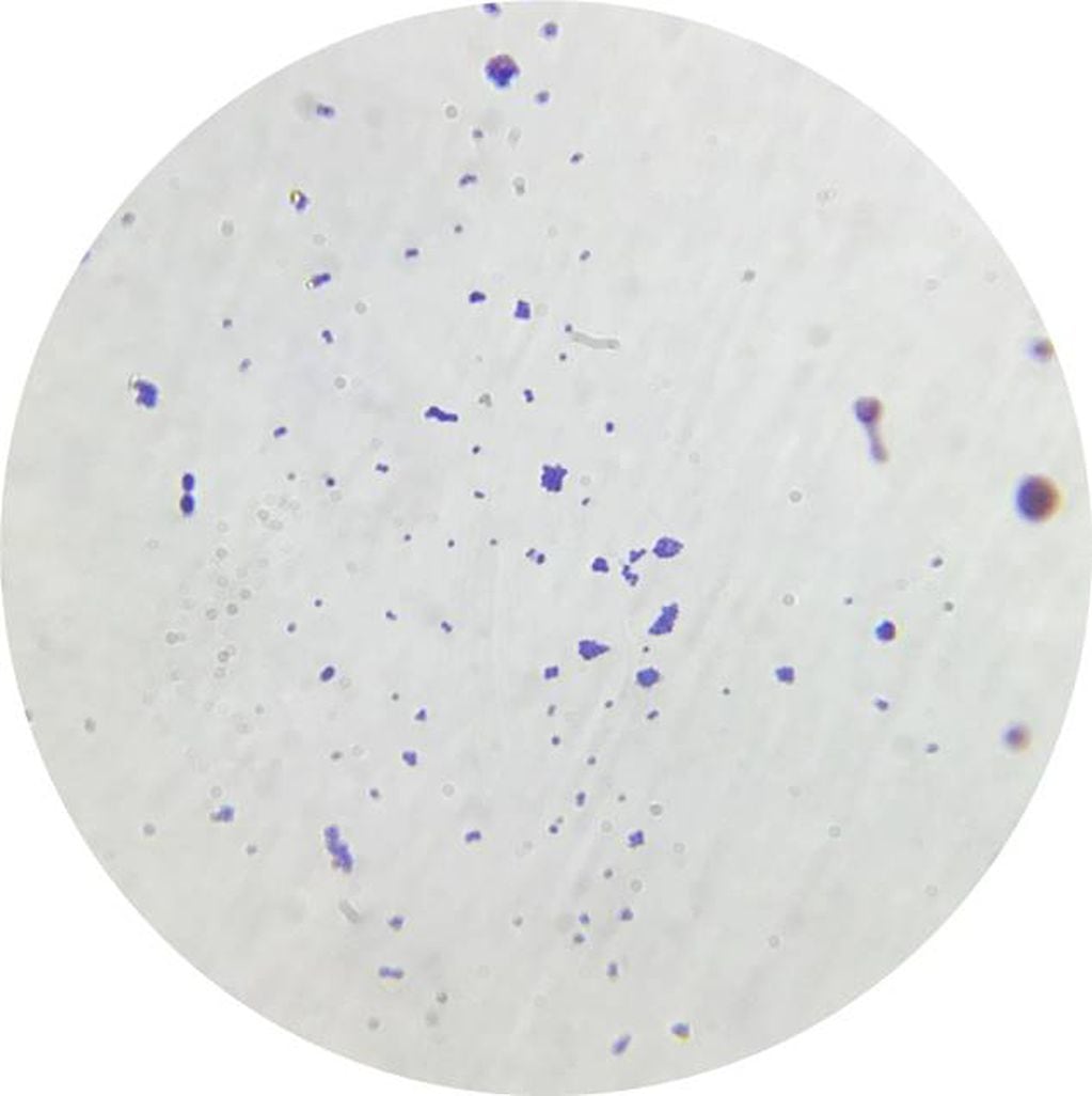 Staphylococcus aureus células