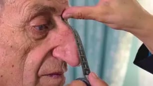 Un hombre turco tiene la nariz más larga del mundo: mide 9 centímetros y entró al Guinness