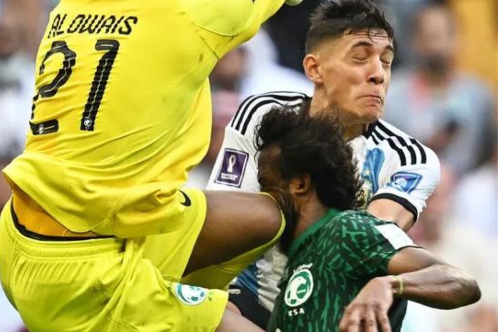 Imágenes sensibles: así quedó el cráneo del jugador saudí tras chocar con la rodilla del arquero de su equipo