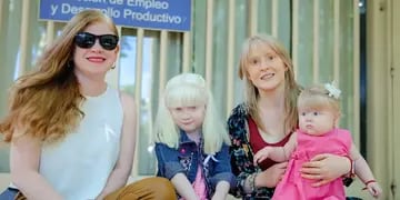 Albinismo San Juan