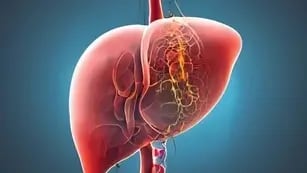 La enfermedad grasa del hígado, actualmente denominada esteatosis hepática es una epidemia oculta